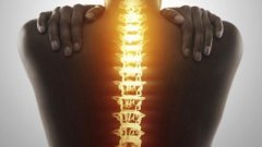美式脊椎矫正服务中心:脊椎病出现这些严重的症
