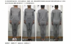 北京刘冠辰ART-人体骨架矫正平衡术案例展示！