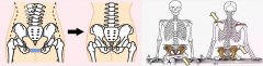 ART人体骨架矫正平衡术为什么能做到盆骨矫正？